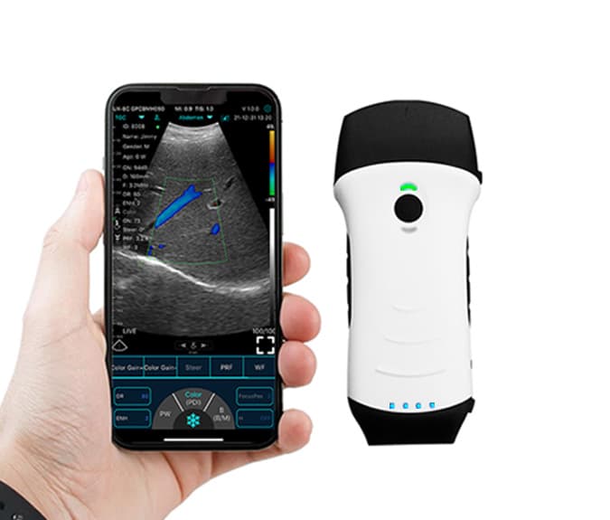 Ultrassom portátil wireless com smartphone